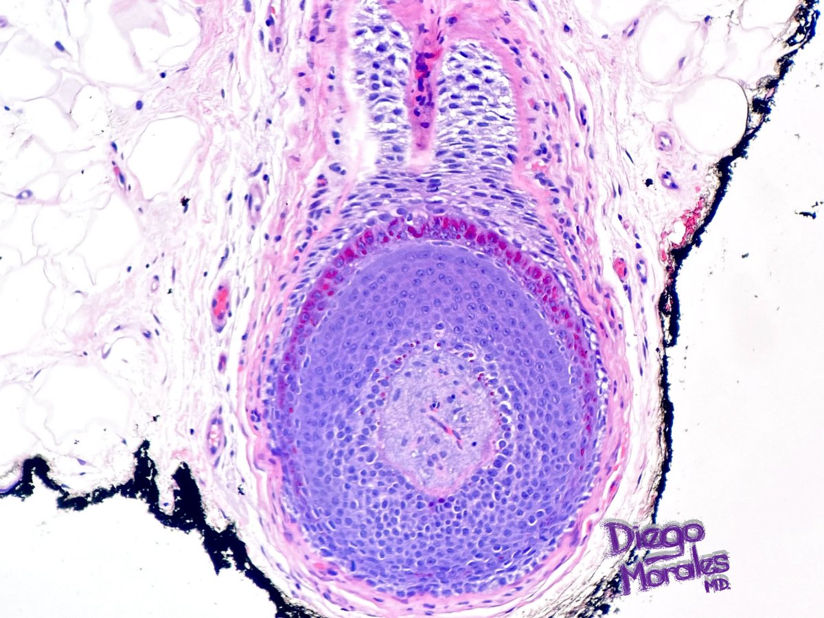 Diego Morales, MD tweet media