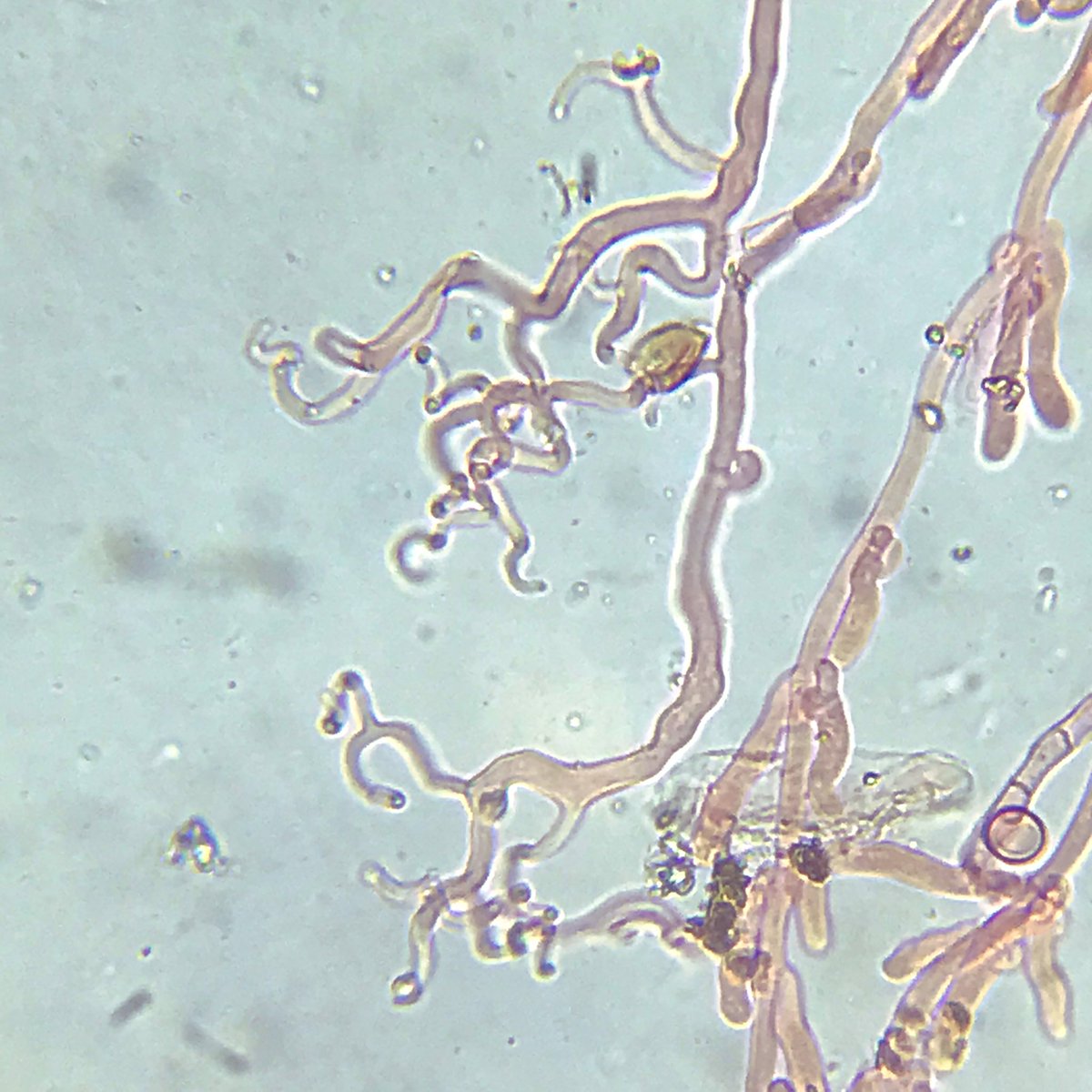 floodenheim's tweet photo. A new one for me - Phleogena faginea. In years gone by I would have spent hrs stuck in my book of slime moulds, so must be getting better at this game. Actually it’s fungal - a tiny puffball. Super simple basidia, thick-walled pores, scattered clamps, nice curlicues #fungi https://t.co/6VOFSGf937