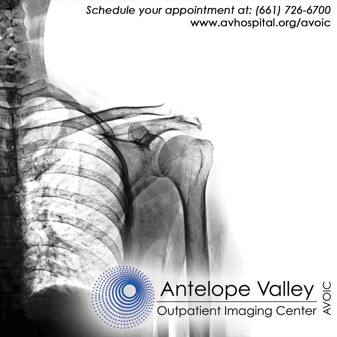 avmedicalcenter's tweet photo. AVOIC offers full service, patient-focused, quality outpatient radiology centers throughout the Antelope Valley. To schedule an appointment call (661)726-6700 #antelopevalleyoutpatientimagingcenter #avoic #radiology #xrays #mri #patients #scan #health https://t.co/34sXdzQNCd