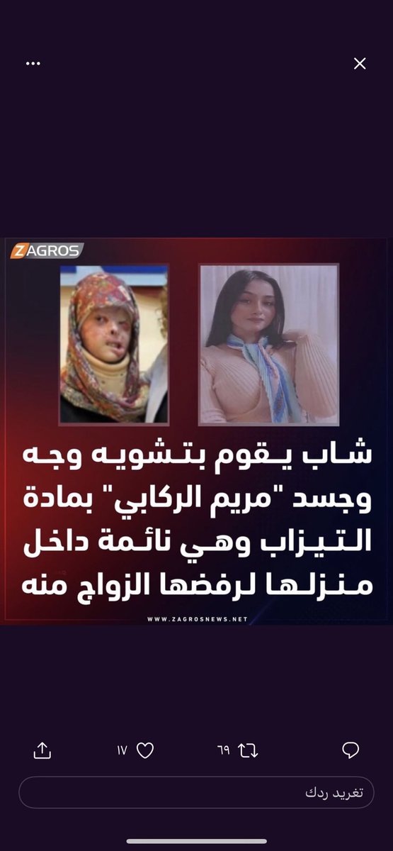 انتهت حياتها واحلامها بسبب شخص (غريزته حيوانية) لا اعرف كيف لانسان يصل به الحقد والانتقام الى حد هدم حياة انسانه
المرحلة الي واصليها من الوحشية و فقدان الانسانية والضمير لاتوصف! اين القضاء العراقي 
العقوبة المناسبة لهذه الجريمة 
هي رش التيزاب  على وجه الجاني 
حتى يكون عبرة لغيره