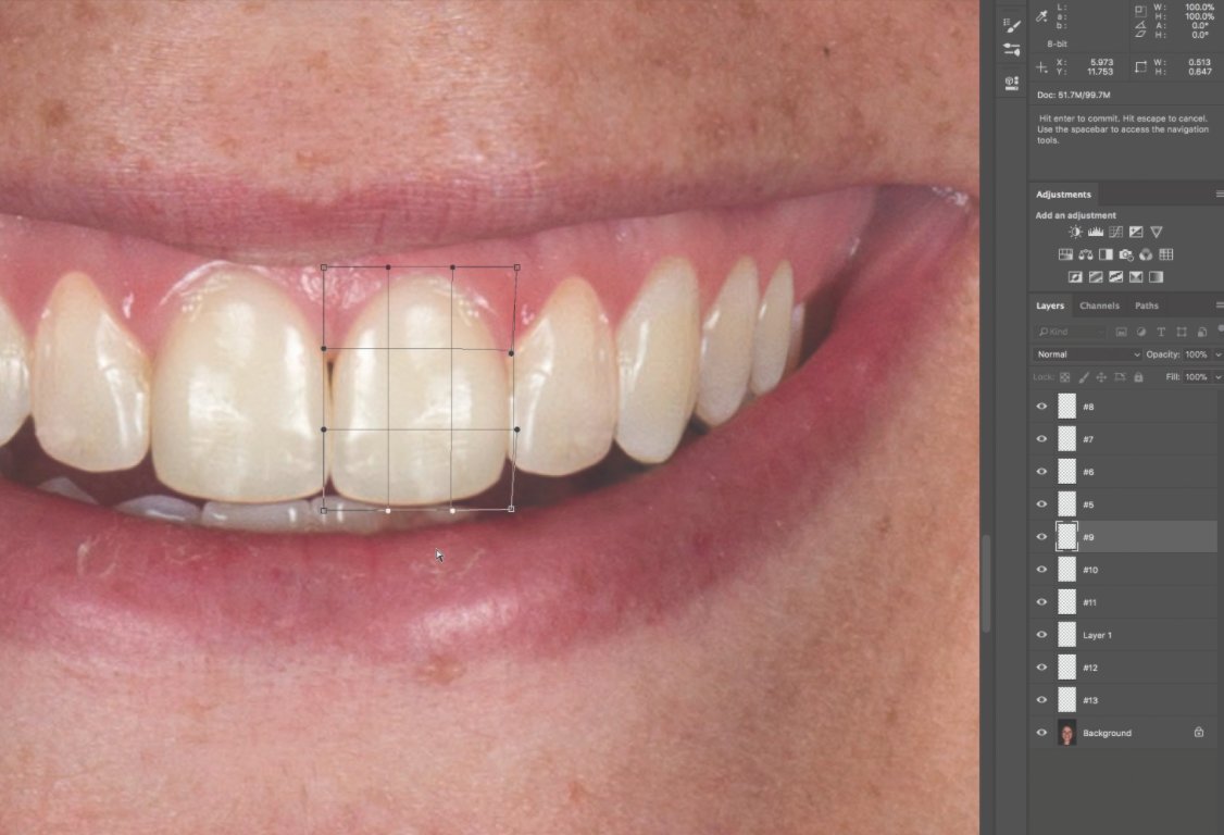InDentalTech's tweet photo. Read “The Photoshop Smile Design Technique” by Edward A. McLaren, DDS, MDC, and Ronald E. Goldstein, DDS, take a short quiz, and earn CE credit! https://t.co/Se5BUjsJng #ContinueYourEducation https://t.co/w45EDOzSQK