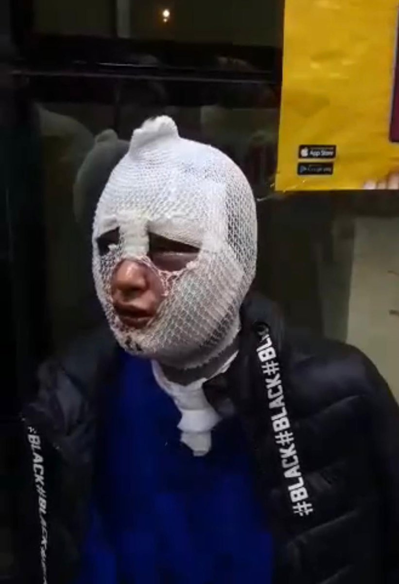 Intim joylarda terining oq doglari