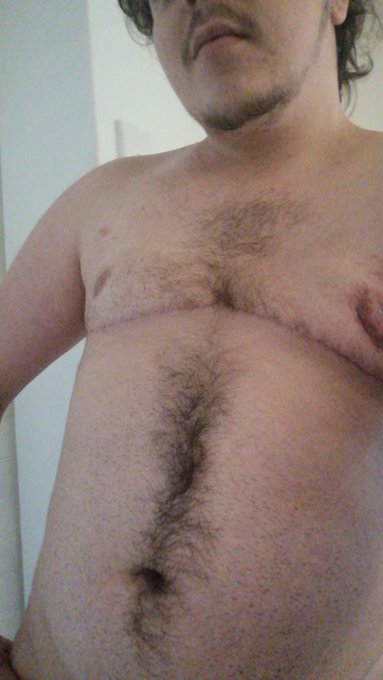 Proud of my scars 💜 https://t.co/uj7tscIA1V<a href="/tag/transisbeautiful"class="tags"><span>#transisbeautiful</span></a><a href="/tag/transporn"class="tags"><span>#transporn</span></a><a href="/tag/ftmporn"class="tags"><span>#ftmporn</span></a>