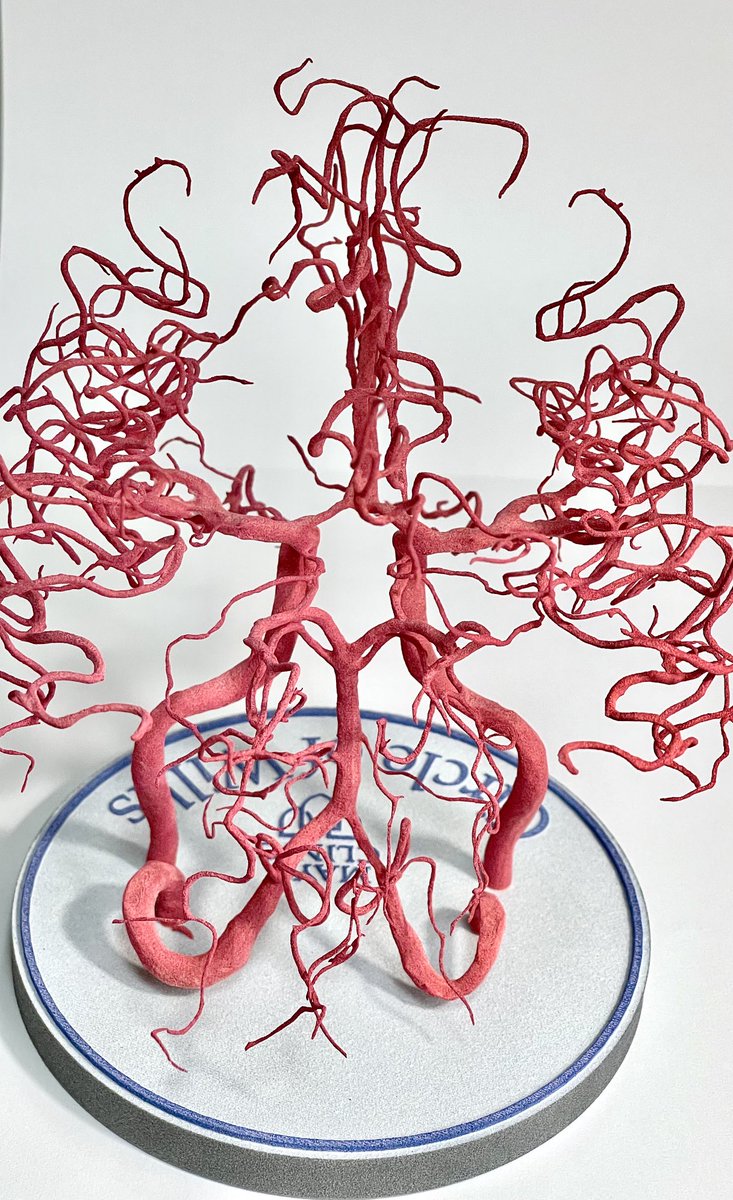 EWijdicks's tweet photo. Here is how a real circle looks like ( courtesy of Dr Morris and his terrific 3D lab) https://t.co/PxIrKGgJGF