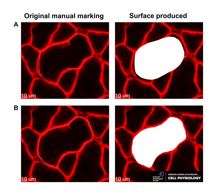 AJPCellPhys's tweet photo. New #LettersToTheEditor discuss a methodology for measurement of #CellSize:
1 - https://t.co/aAu2GT3I3X
2 - https://t.co/qnxNeKT0hX
#MuscleFiber #MuscleAtrophy https://t.co/zphqxnyvmx