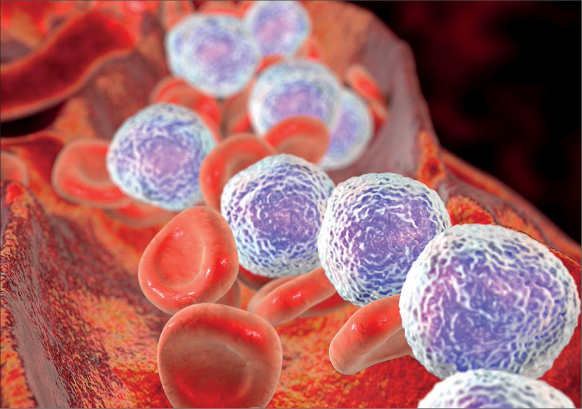 AusSMC's tweet photo. 🧒 @sahmriAU is working on improving the outcomes for childhood leukaemia patients with Down Syndrome
⚕️Check out their findings over on #Scimex - https://t.co/lA4QYAQBMy https://t.co/Bwg7zDFccs
