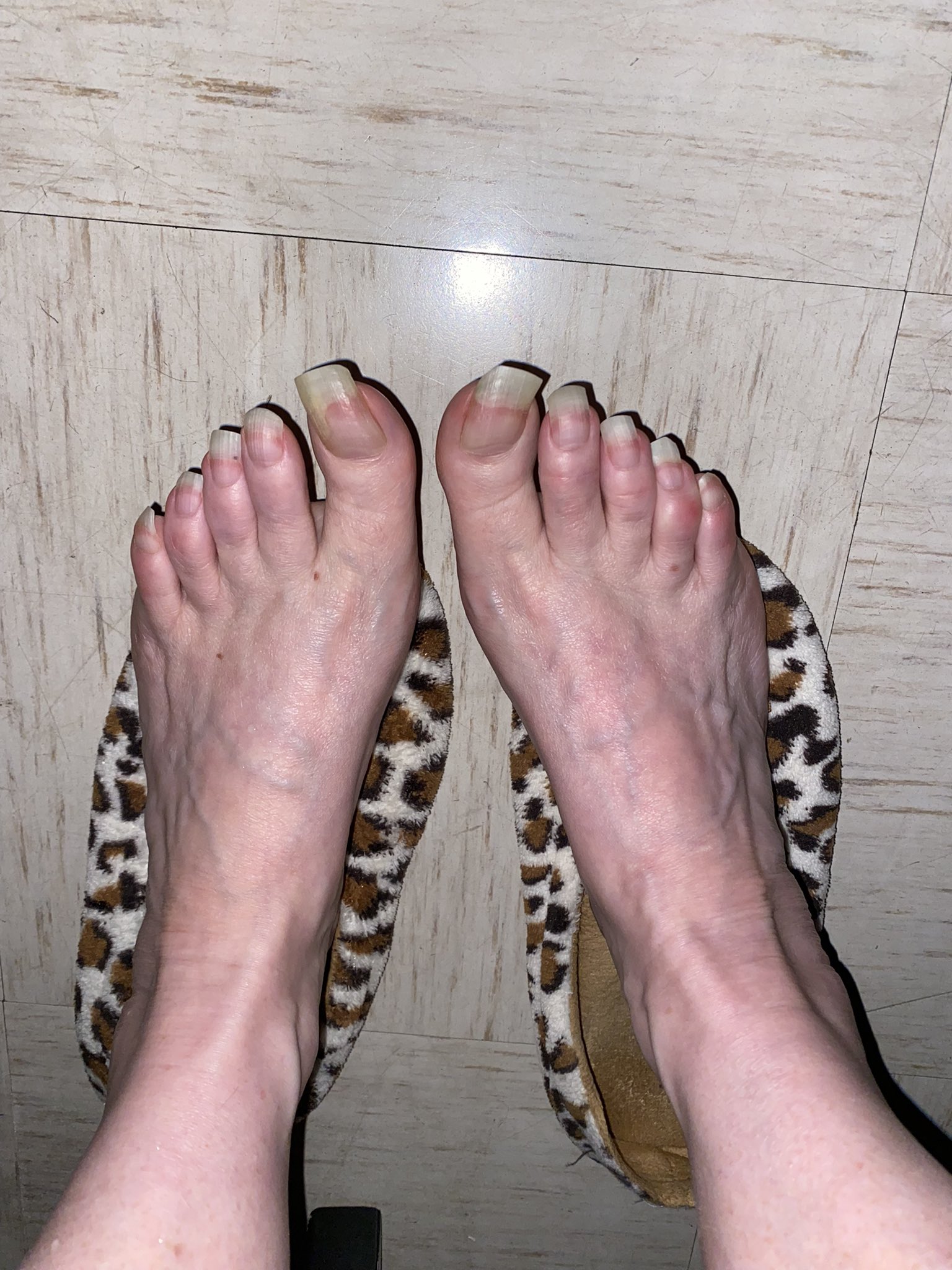 Natural Toes (@natural_toes) / X