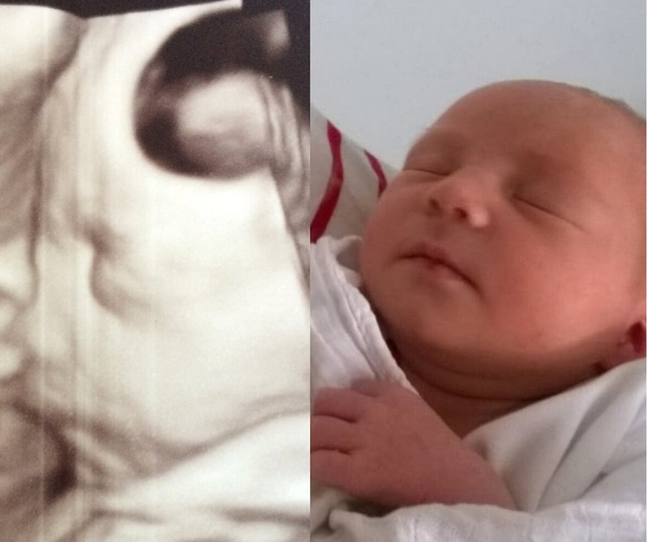 fetal_uk's tweet image. #3Dbabyscan @ 6 weeks before birth ⏩ 6 weeks after birth

✅Scans in 3D are usually poss after 12 weeks
✅3D is included in the scan price
✅3D allows you to see what baby will look like 

📅BOOK YOUR 3D SCAN HERE: ow.ly/JLiL50HcS4J

#3Dscan #babyscan #fetalmedicineuk