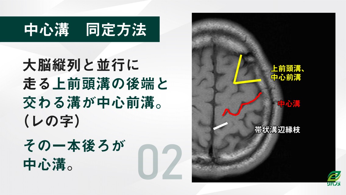 脳画像 標準PT/OT/ST別巻 71asYgEt7lL._UF350,350_QL50_.jpg