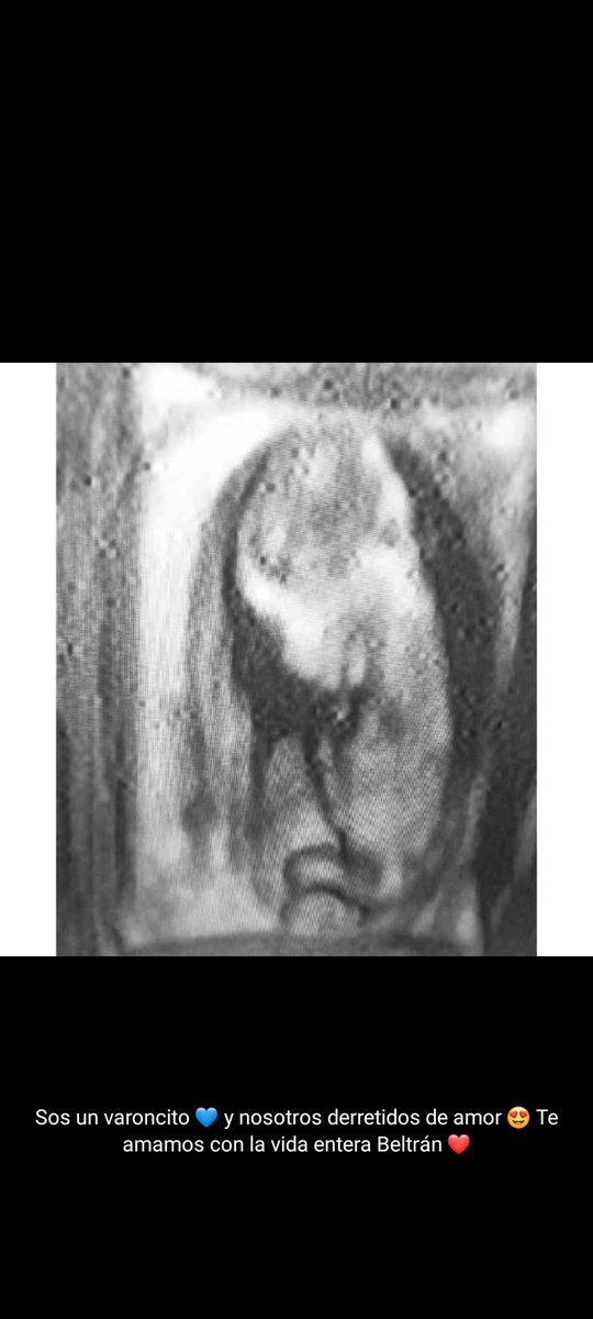 Bueno día mi beltran no sabes cuanto te ama papá ♥️