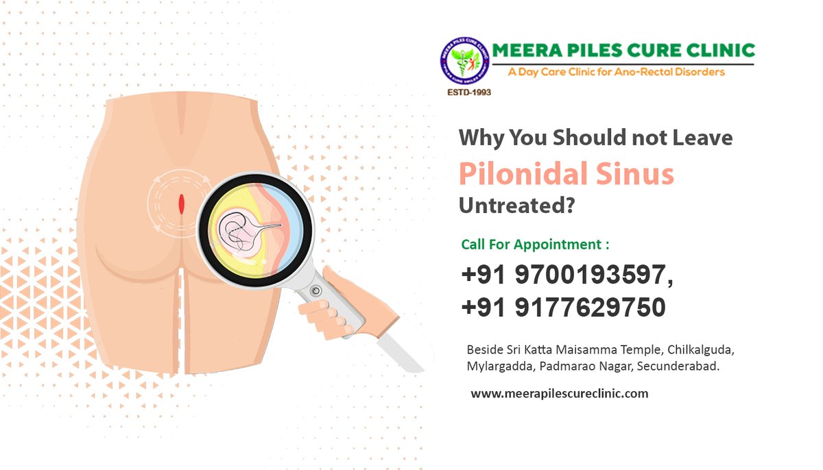 MeeraPiles's tweet image. #pilonidalsinus #pilonidalcyst #pilonidalsurgery  #ksharsutra
Pilonidal Sinus is a painful condition in which cyst is formed near the tailbone or at the upper end of the butt between the two butt cheeks.
Book An Appointment: 9177629750 / 9700193597
Visit: meerapilescureclinic.com/Pilonidal-Sinu…