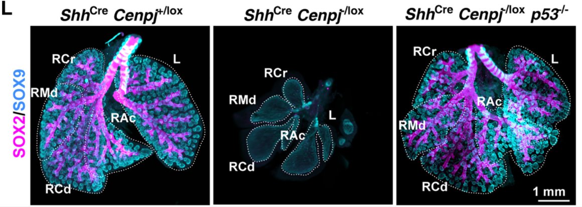 Professor Booty PhD (@profbootyphd) on Twitter photo Lovely paper from the <a href="/ReiterLab/">Reiter Lab</a> - would be great to include in a developmental biology course. Almost painfully beautiful figures. cell.com/developmental-… Lovely paper from the <a href="/ReiterLab/">Reiter Lab</a> - would be great to include in a developmental biology course. Almost painfully beautiful figures. cell.com/developmental-…