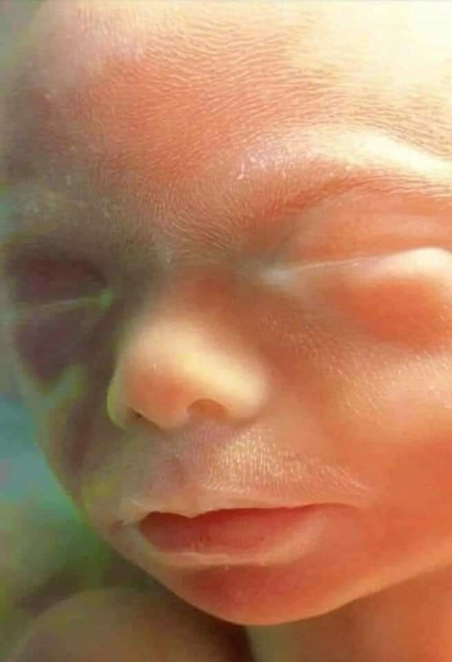 @gozunew @DrBobEsquire1 Oh my! Here's a 20 week old random clump of cells in utero. Planned Parenthood was founded by the lovely Margaret Sanger Harris, a darling of the KKK. Referred to minorities as human weeds.