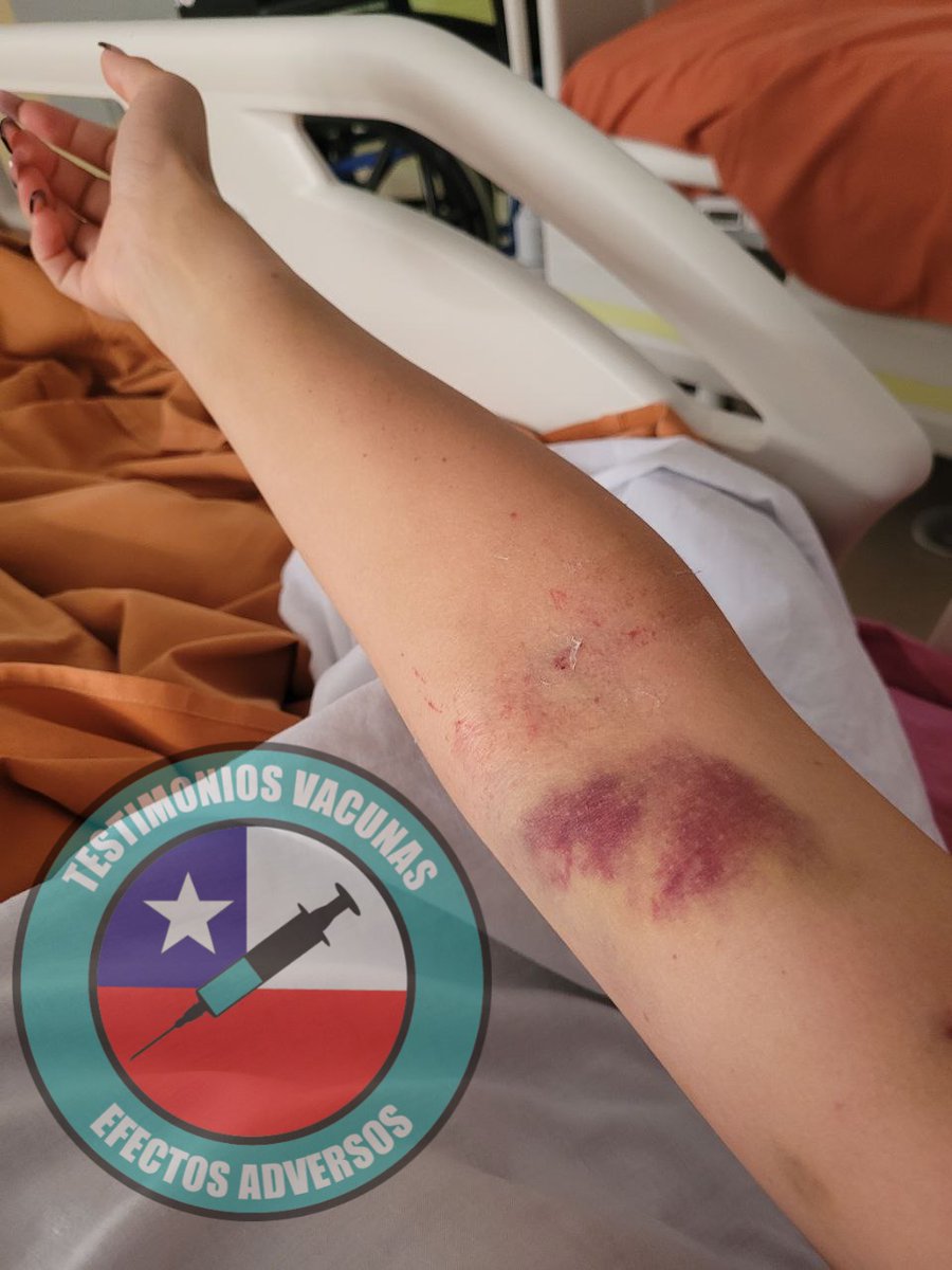 tvc_chile's tweet photo. #TestimoniosVacunasChile #EfectosAdeversos https://t.co/zxISj5cGjm