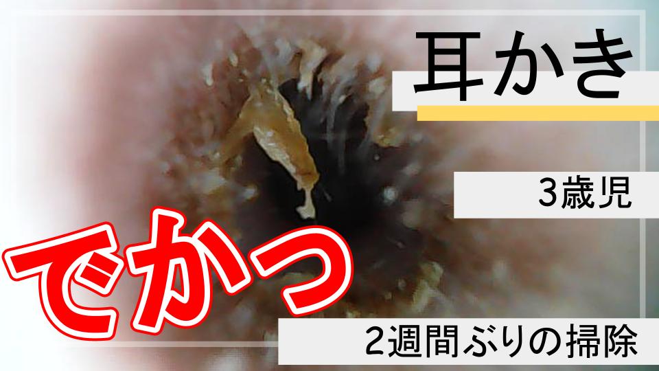 kataage_j's tweet photo. 【耳かき】２週間耳垢を溜めました！ごっそりと取れます！ https://t.co/sAueYRzh0l @YouTubeより https://t.co/vmB09rfJVt