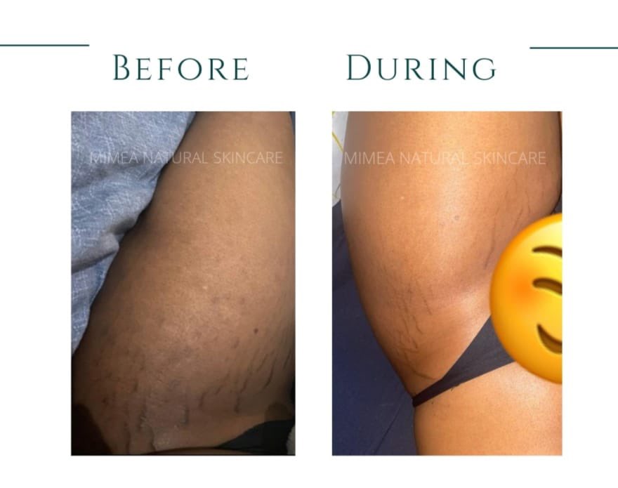 Mandisa_Snushu's tweet photo. Hi I am Mandisa, I sell handmade natural skincare products. I have a body butter and tissue oil which reduces the appearance of dark spots, stretch marks and uneven skin tone. I courier nationwide. Each product is R150.

#Mandisa 
#NaturalSkincare https://t.co/VqsYBaKnHb