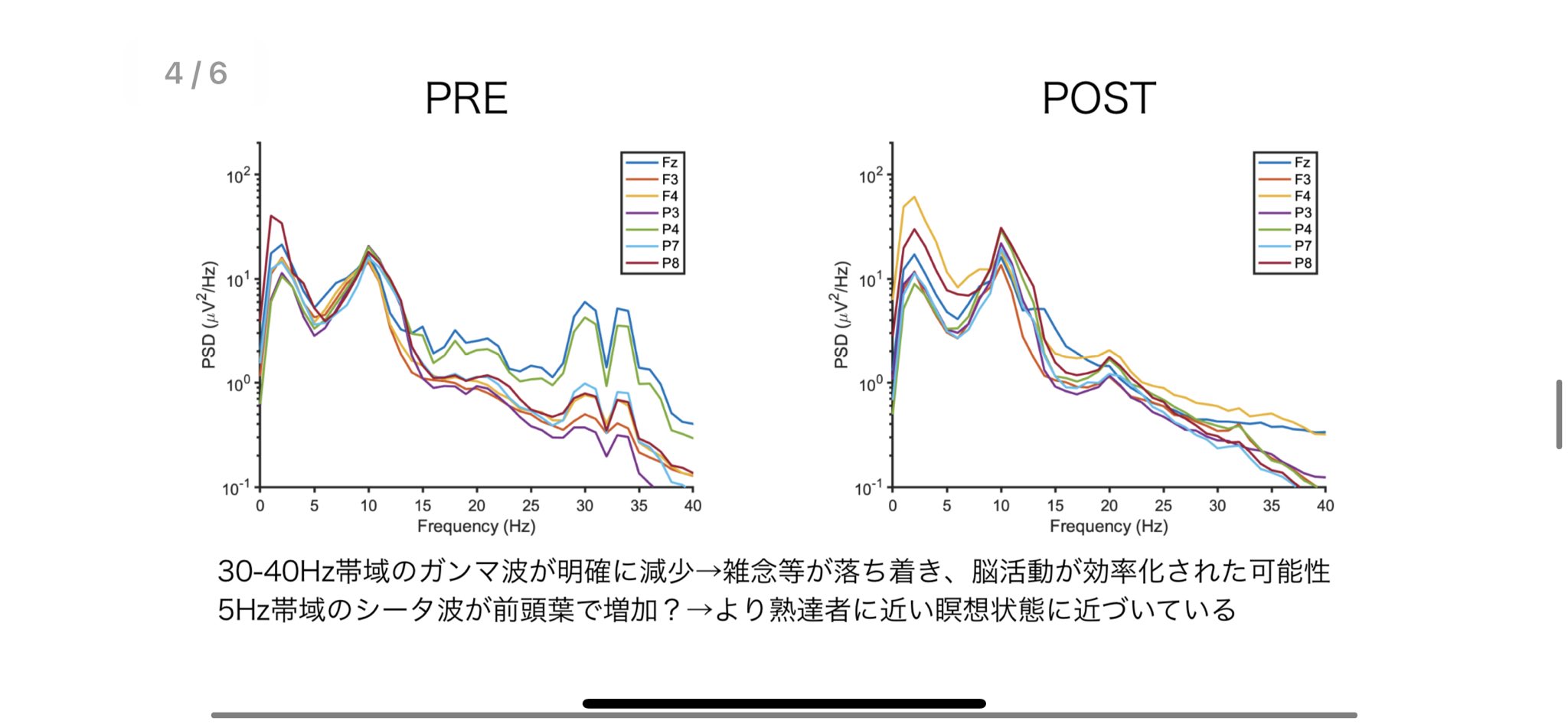 熊谷祐 瞑想アプリrelook 現在40万dl超え 創業者 10チャンネルあるガチな脳波計であるopen iで 1ヶ月マインドフルネス脳トレーニングの前と後の貴重なデータ 日本初かも 雑念に関わるガンマ波 30 40ヘルツ が明確に減少 集中力に関係するシータ 熊谷祐 瞑想アプリrelook 現在40万dl超え 創業者 10チャンネルあるガチな脳波計であるopen iで 1ヶ月マインドフルネス脳トレーニングの前と後の貴重なデータ 日本初かも 雑念に関わるガンマ波 30 40ヘルツ が明確に減少 集中力に関係するシータ
