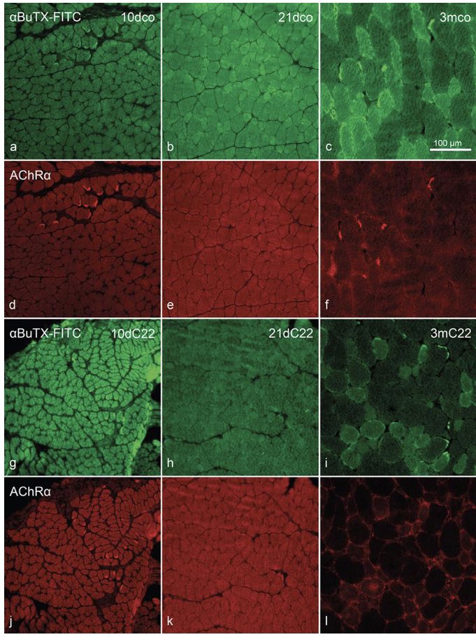 Next up from our special issue - Early changes in #skeletalmuscle pathology in a mouse model of #CMT1A, showing muscle atrophy could occur before the extrajunctional expression of AChR

Full report here: bit.ly/3FEZi3O

#myotwitter #neuromuscular #charcotmarietooth