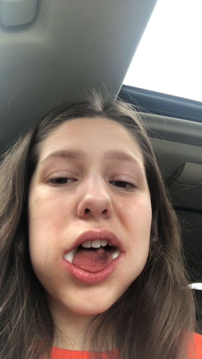 annaewoods's tweet photo. A short story of woods girls post wisdom teeth surgery choose your fighter https://t.co/ybKHTeKeCj