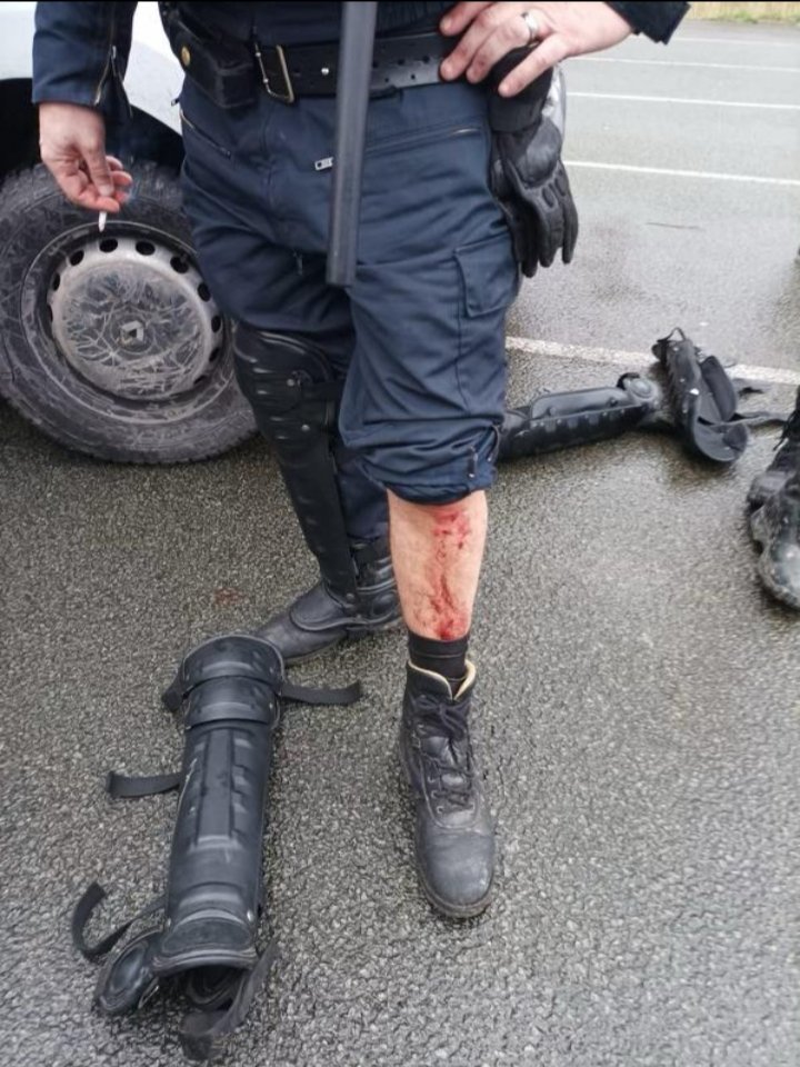 CRSUNSAPolice's tweet photo. Migrants Calais:
Démantèlement ce matin d un camp, GM &amp; 7 CRS blessés. Prompt rétablissement à nos collègues blessés. Violences inouïes des migrants lors de ces opérations, utilisation des moyens de protection et de défense plus que nécessaire. https://t.co/JeOF2DLFay