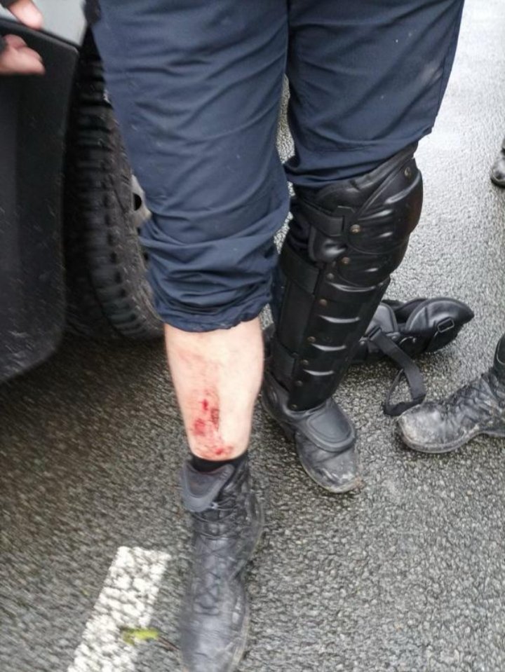 CRSUNSAPolice's tweet photo. Migrants Calais:
Démantèlement ce matin d un camp, GM &amp; 7 CRS blessés. Prompt rétablissement à nos collègues blessés. Violences inouïes des migrants lors de ces opérations, utilisation des moyens de protection et de défense plus que nécessaire. https://t.co/JeOF2DLFay