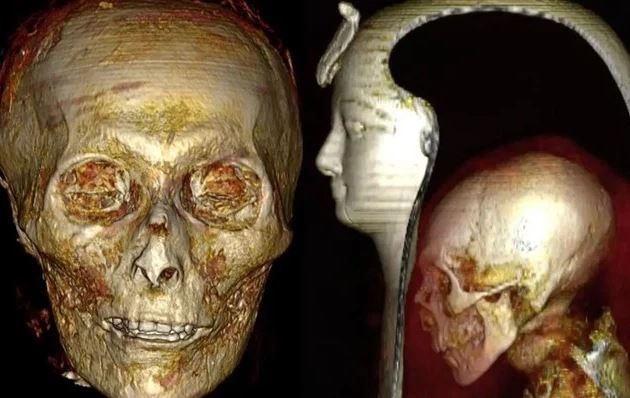 naftemporikigr's tweet image. Στο «φως» τα μυστικά του Φαραώ Amenhotep Ι, έπειτα από 3.500 χρόνια naftemporiki.gr/story/1817078 #CairoUniversity #Ägypten #Pharao #Amenhotep #Mumie #egypt #nile #nileriver #mummy #ctscan #pharaoh #archeology #archeologist #excavation #deirelbahari #naftemporiki