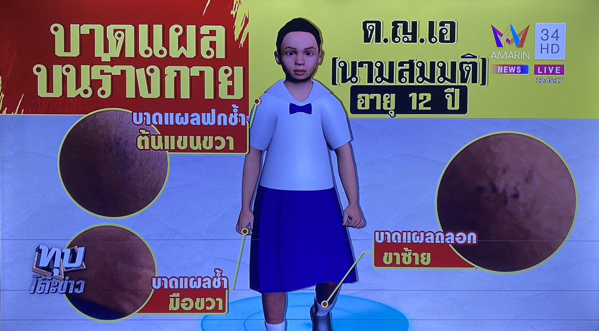 BeautyDiaryNews's tweet image. เด็ก ป6 ซึมๆไปรร ครูสงสัยคอยดูพฤติกรรม สรุปน้องเล่าว่าโดนพ่อแท้ๆข่มขืน และทำร้ายร่างกาย หนักสุดกระทืบ น้องพยายามฆ่าตัวตายด้วยการกินยาพารา พ่อไม่ให้มารร น้องอาศัยตอนพ่อหลับหนีมา รร. ครูพาไปแจ้งความ ตอนนี้น้องอยู่ในความดูแลของเจ้าหน้าที่ พ่อปฎิเสธทุกอย่าง เพื่อนบ้านบอกพ่อเป็นคนดี