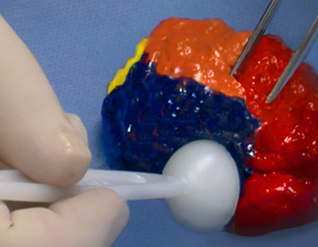 VectorSurgical's tweet image. Surgeons prevent error by using #MarginMarker, the sterile ink kit for intraoperative tissue orientation. Visit VectorSurgical.com to request a sample.