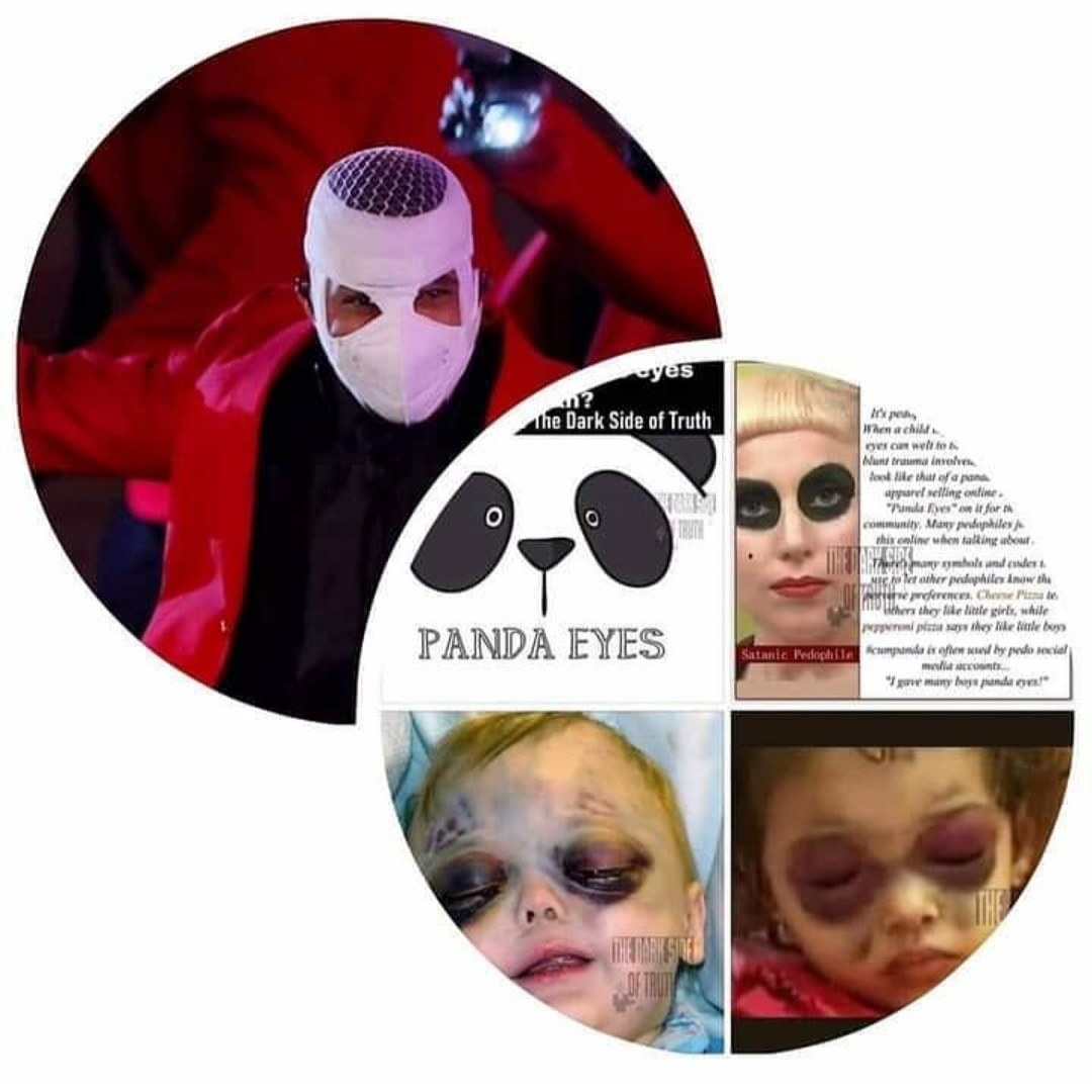 blessed041977's tweet photo. IYKYK...but for those that don't this is called panda eyes. Children are severely beaten to get their adrenaline pumping and then drained of blood like animals. The blood is then drank or synthesized into a drug they put into their eyes for a high and to maintain youthfulness🤮 https://t.co/iTgQBOMYrm