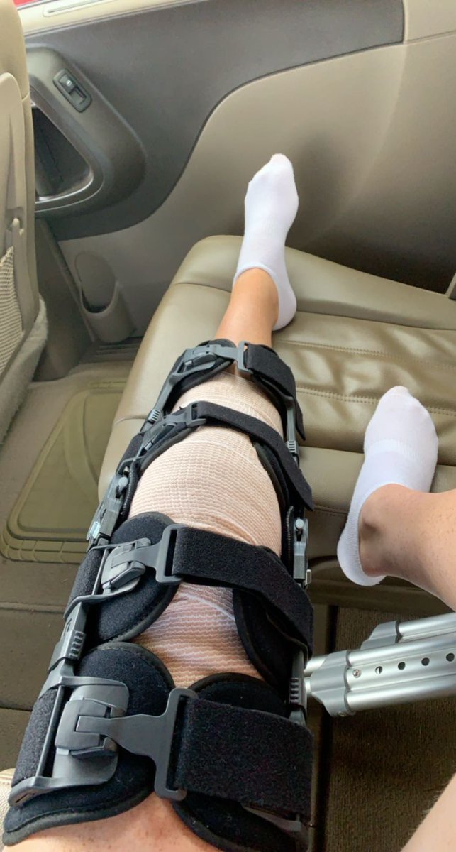 Anna Kate Hill (@annakatehill1) on Twitter photo Today marks 6 months since my ACL surgery! Thankful for the strength i’ve had to make it this far. I can’t wait to continue my rehab, and get back on the field! <a href="/ATLPremier_Ray/">AtlantaPremierElite-Ray</a> <a href="/CoastalSoftball/">Coastal Carolina SB</a> <a href="/BrenauSoftball/">Brenau Softball</a> <a href="/KSUOwlsSB/">Kennesaw State Softball</a> <a href="/GamecockSoftbll/">South Carolina Softball</a> <a href="/UGASoftball/">Georgia Softball</a> <a href="/CofCSoftball/">Charleston Softball</a> Today marks 6 months since my ACL surgery! Thankful for the strength i’ve had to make it this far. I can’t wait to continue my rehab, and get back on the field! <a href="/ATLPremier_Ray/">AtlantaPremierElite-Ray</a> <a href="/CoastalSoftball/">Coastal Carolina SB</a> <a href="/BrenauSoftball/">Brenau Softball</a> <a href="/KSUOwlsSB/">Kennesaw State Softball</a> <a href="/GamecockSoftbll/">South Carolina Softball</a> <a href="/UGASoftball/">Georgia Softball</a> <a href="/CofCSoftball/">Charleston Softball</a>