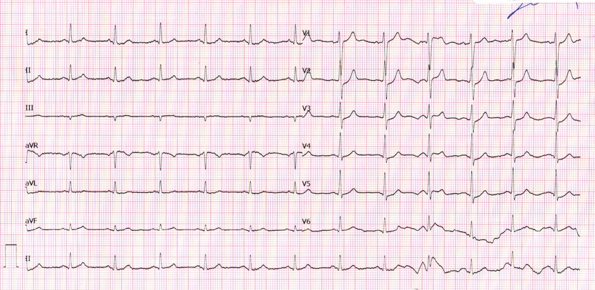 Emre Aslanger tweet media