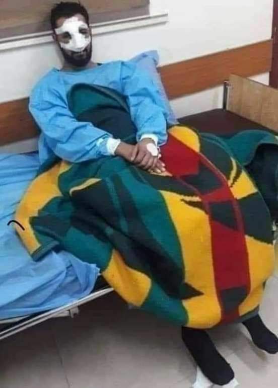 اقدمت امرأة عشرينية على عض انف زوجها حتى قطعته بسبب علاقاته مع فتيات كثر على تطبيق الماسنجر ..
 وأوضح التقرير الطبي أن الشاب تعرض لـ«العض» على انفه بطريقة وحشية ادت الى انقطاعه بالكامل ، هذا وتم القبض على الزوجة ونقل الزوج الى المشفى وحالته الصحية متوسطة ...📚📚📚