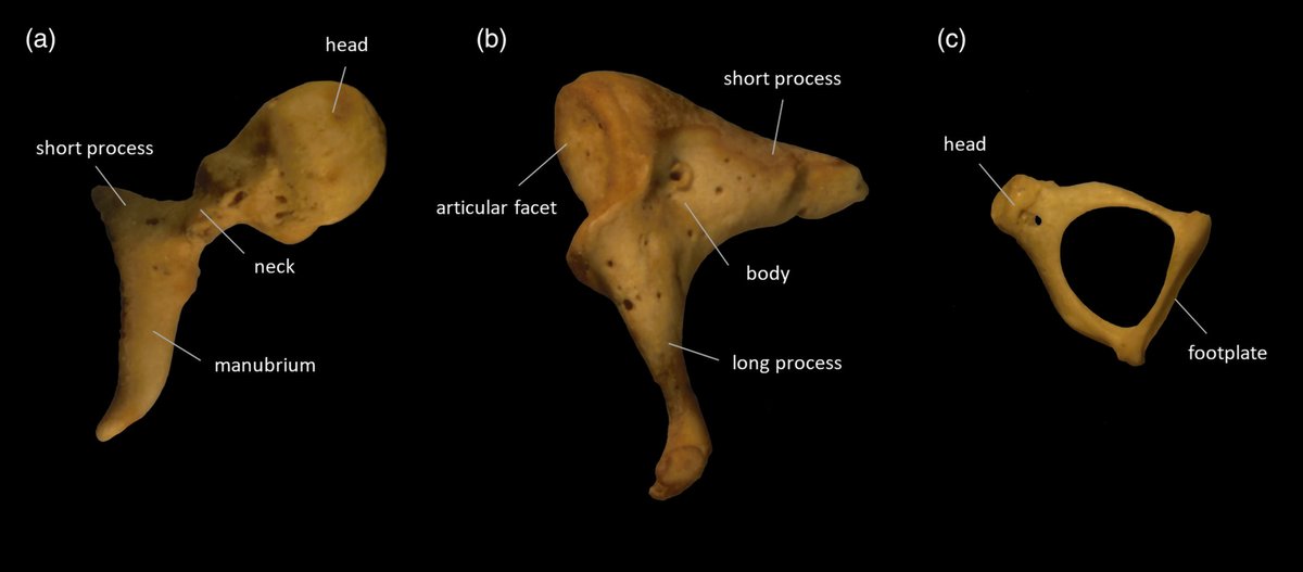 AnatRecord's tweet photo. Learn about morphometry of auditory ossicles (incus, malleus, stapes) in medieval human remains:
https://t.co/GY2iW2ezGQ
#bioarchaeology #ossicles #InnerEar #SkeletalBiology #BiologicalAnthropology #PhysicalAnthropology https://t.co/p2lhxDeyLY