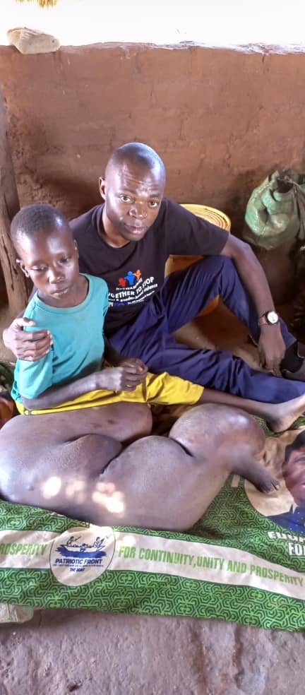 MaindaSimataa's tweet photo. A journalist sent me this, a cry for help for this boys future and family. Alone, as an individual, even as a councillor, I'm helpless. But perhaps if we can #retweet this, it can reach someone somewhere, with the capacity to give this boy help and hope. @HHichilema 
#ZedTwitter https://t.co/SoqLOXuB9y