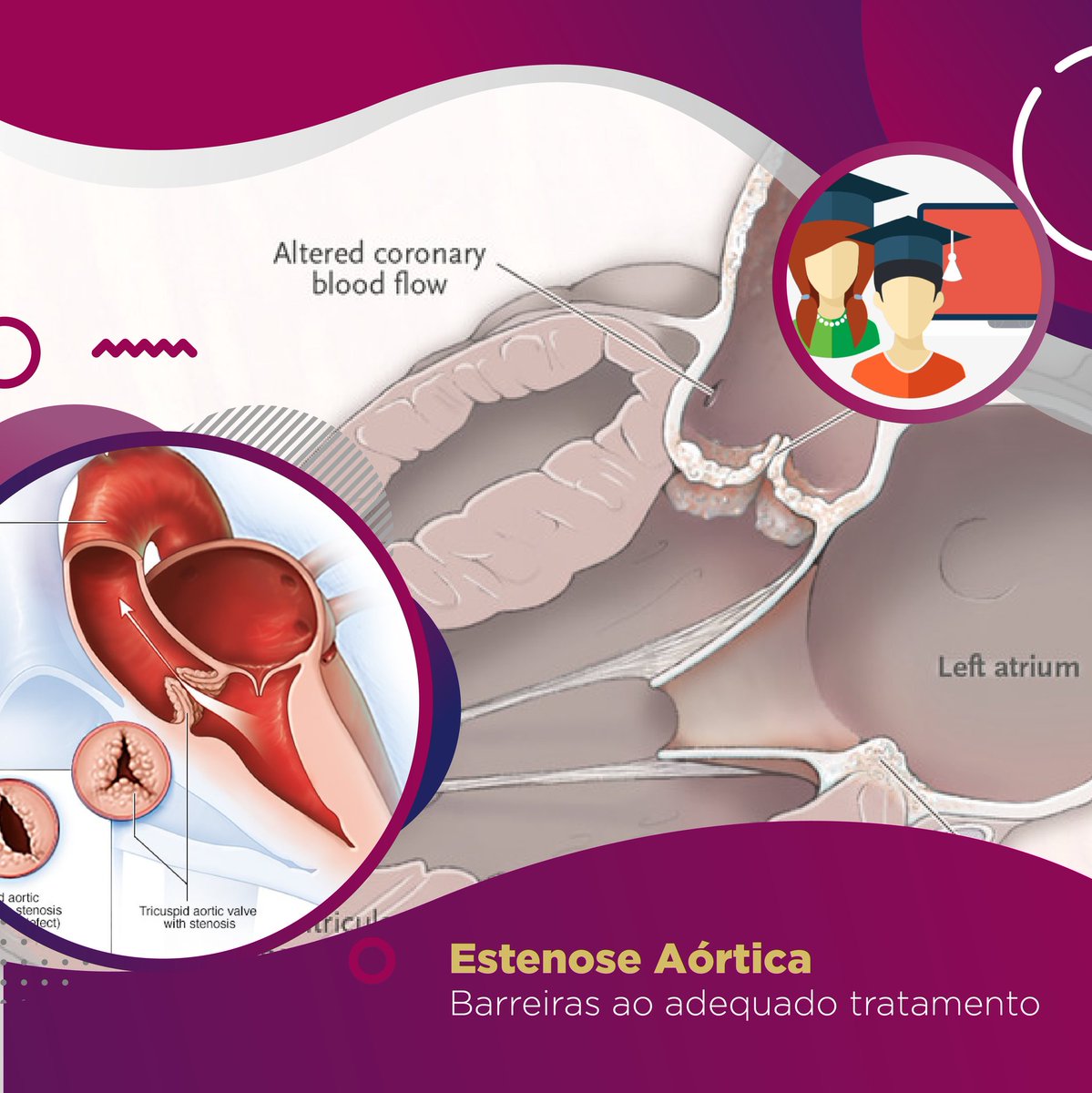 Interventional treatment of aortic stenosis is well established in all guidelines and has positive impacts when properly indicated.
.
But why are not all patients properly referred for intervention?
.
Go to thevalveclub.com.br