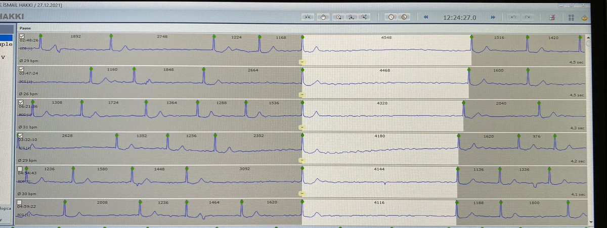 Tolga Aksu, MD tweet media