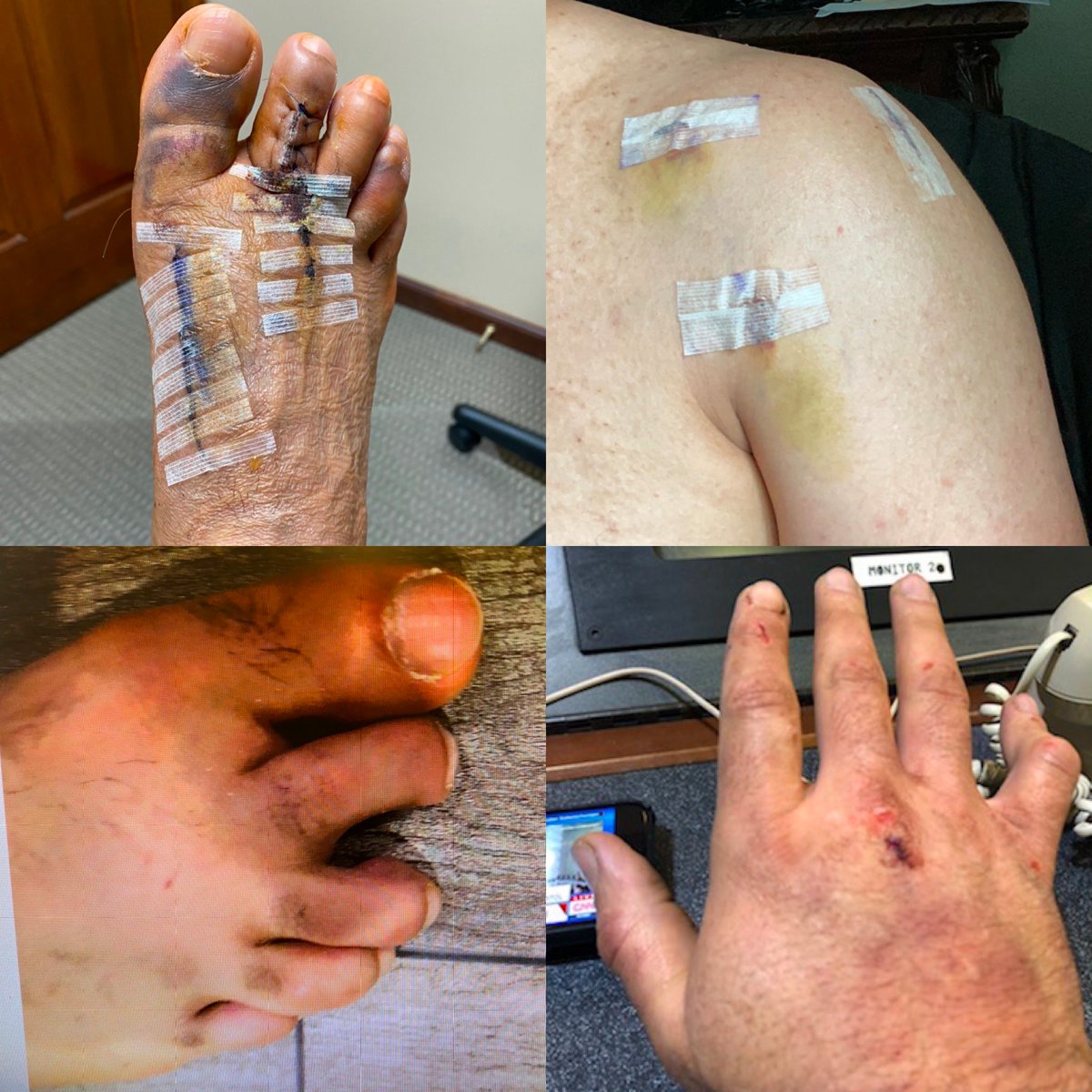 Lizbeth69108338's tweet photo. Capitol Police Sergeant Aquilino Gonell just tweeted out this image, writing: "Mike Pence just called January 6 'that one day in January.' REALLY. These injuries happened to me while I was giving him and others time to escape to safety so he wouldn’t get hanged/executed. To some, https://t.co/HH3AcYXBWa
