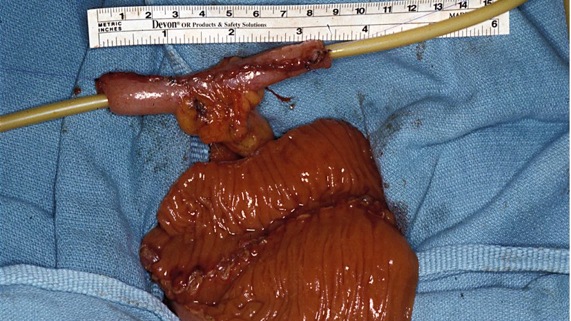 Lenaine Westney tweet media