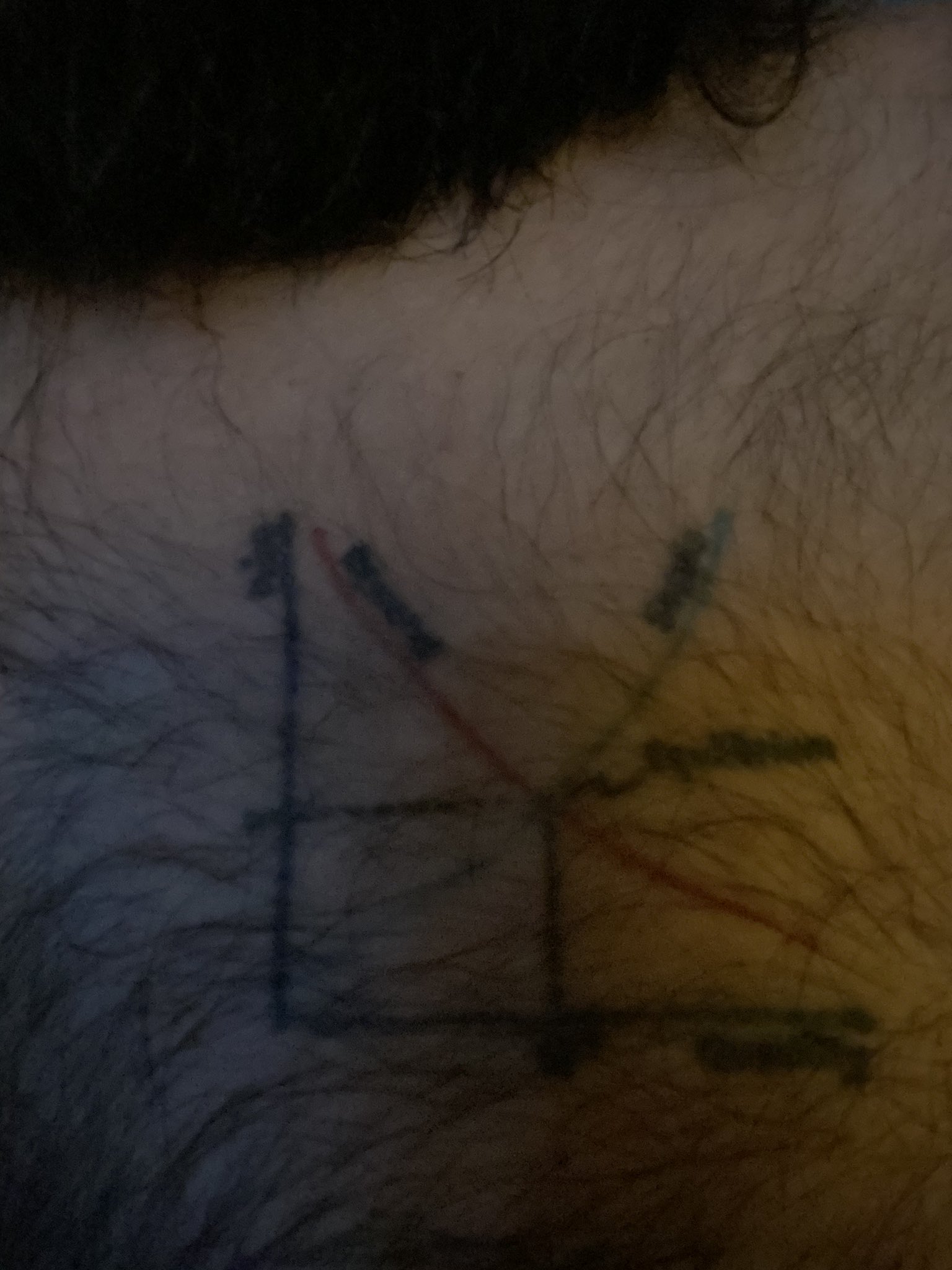 Neck Stitches Tattoo