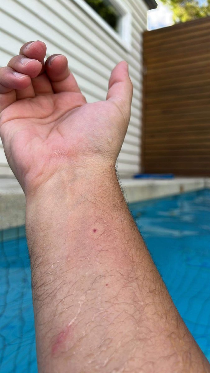 Just got stung by a bee.
2021 just won’t let up 😂