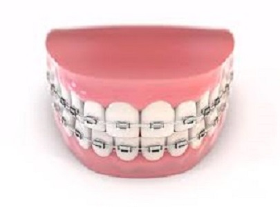 nV_Violet's tweet photo. https://t.co/RSNTrKOgrt 

https://t.co/26736SKO9n

https://t.co/vvuX8NMXPm

They provide various services like teeth whitening, root cannal treatment, etc https://t.co/kt25LD3bX0
