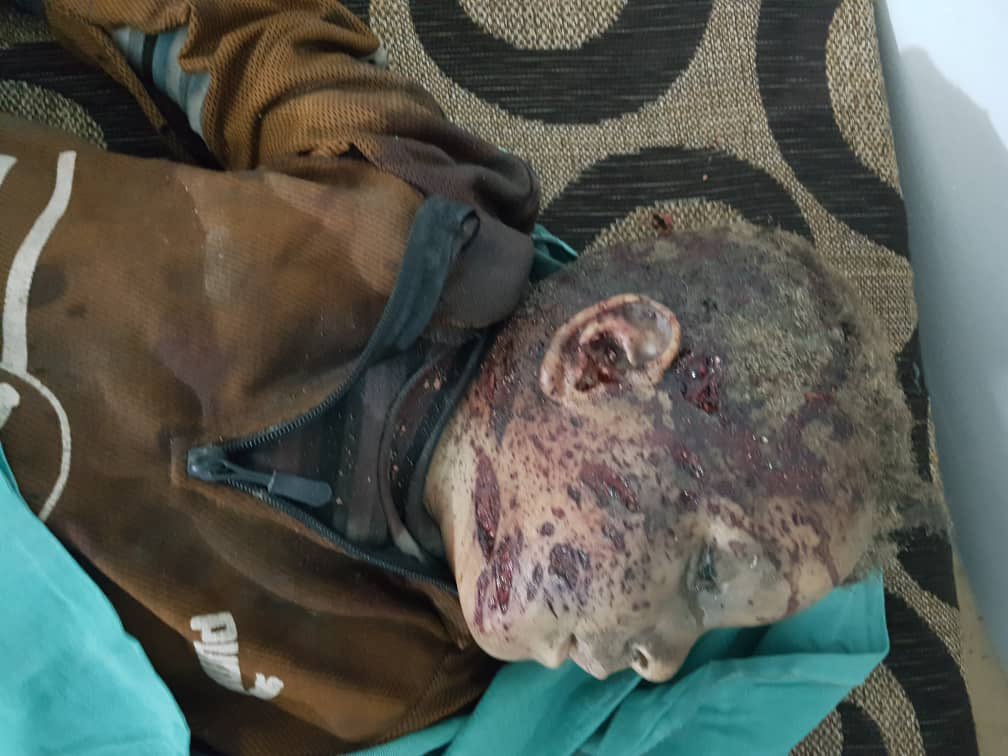 NuriMehmud's tweet photo. استهدف جيش التركي بقيادة أردوغان، والعضو في حلف الناتو يوم أمس منازل المواطنين في قرية الأسدية بناحية زركان حيث أسفر إرهابهم عن فقدان طفل وامرأتين لحياتهم وإصابة خمسة مدنيين بجروح خطيرة بينهم أطفال.
# إرهاب أردوغان https://t.co/YV0T1h1did