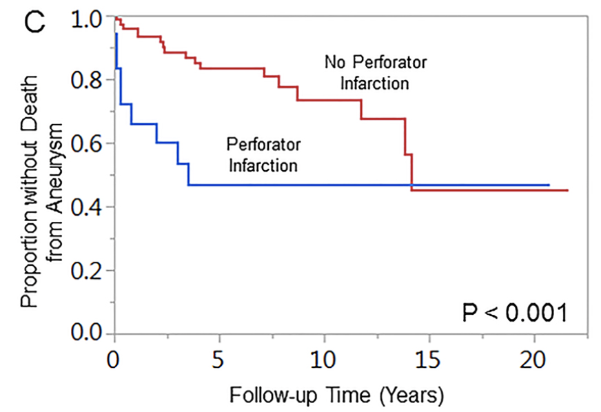 cvsection's tweet photo. Relationship between #fusiform #vertebrobasilar aneurysms and brainstem perforator infarcts clarified: Rinaldo report that a brainstem infarct can be harbinger for #aneurysm #rupture
#stroke #neurosurgery #endovascular
https://t.co/56hwCFvEYk https://t.co/lMWDOciqme