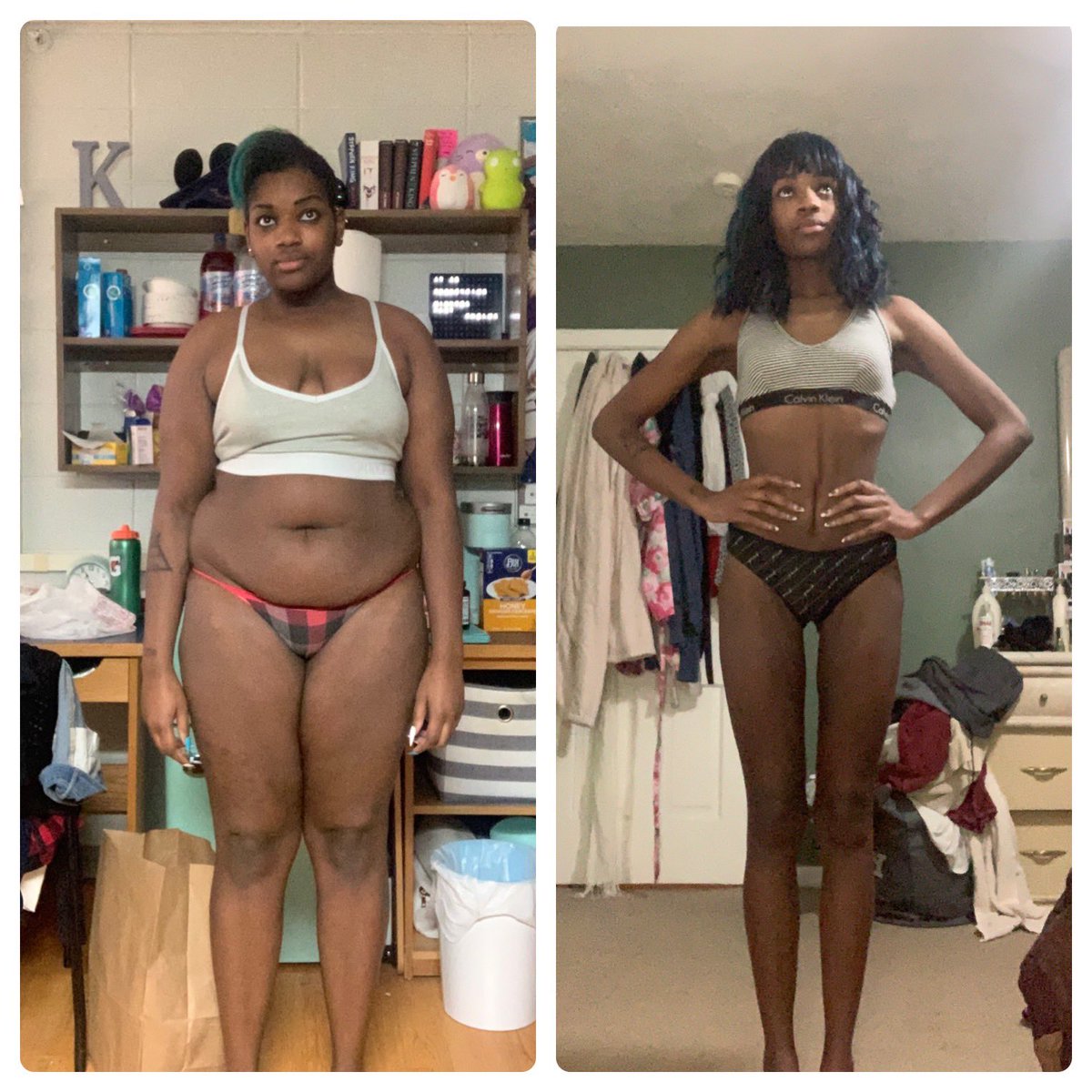 starvingtil100's tweet photo. How was ur year? I went from Obese to Underweight in 10 months,, left me w/ no ass, no tits, and a lil loose skin that looks like a literal autopsy scar 🙃, but that’s a problem for 2022 :)
♡❀˖⁺. ༶ ⋆˙⊹❀♡
Sw: Feb 2021, 207lbs, bmi 35.0 
Cw: Dec 2021, 101 lbs, bmi 17.1 https://t.co/Wp8PEIXATc