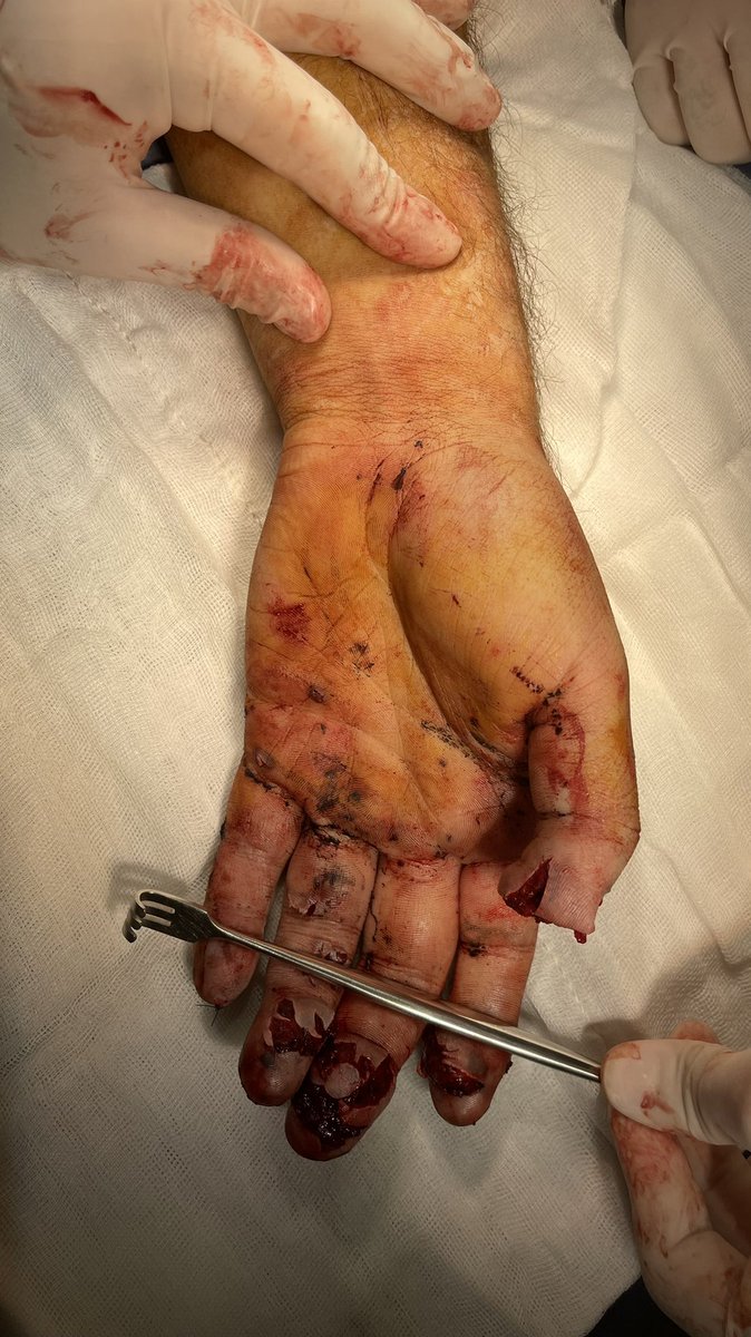 quiquentanilo's tweet photo. Adivinen la causa…😣 22 años https://t.co/zAiUfQePxY