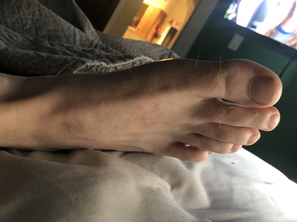 Twoguysfeets's tweet photo. Would you worship my hairy bro toes? #feet #mensfeet #feetworshi̇p #footworshi̇p #toes #FOOTFETİSH https://t.co/FeGyzyfa0w
