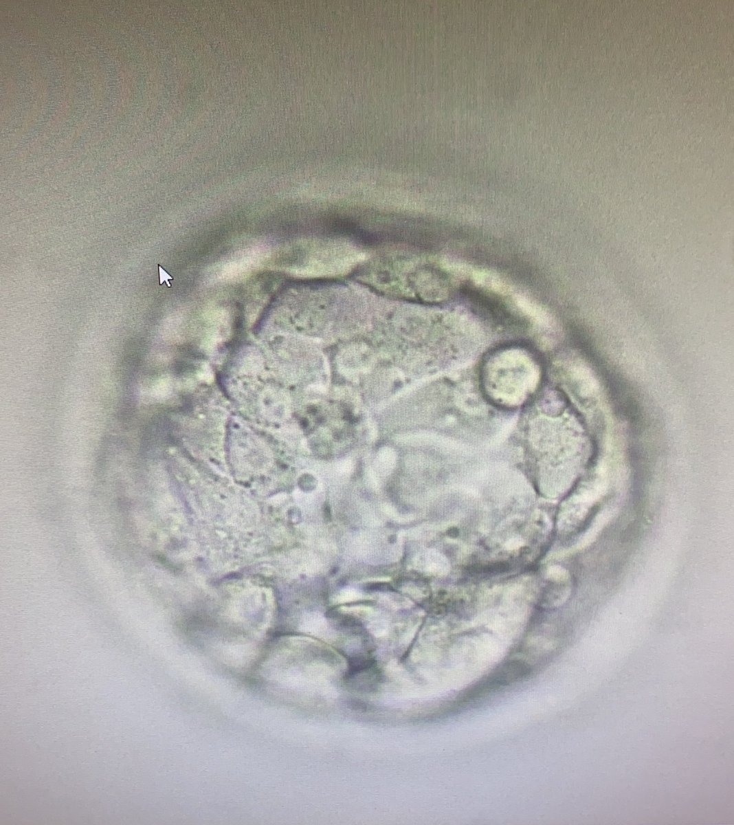 Joyce Leyden tweet media