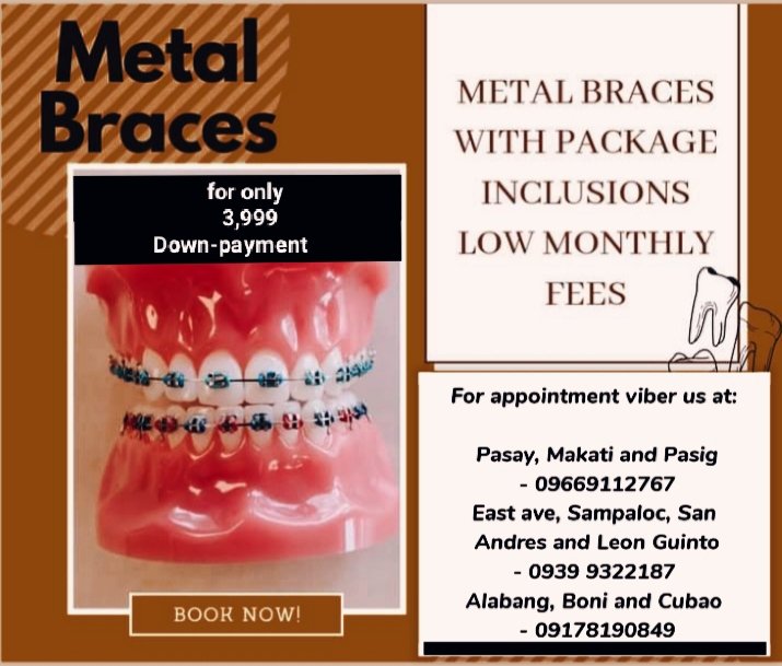 dentalway09's tweet photo. BRACE PROMO PACKAGE
     is still available
Hurry and book your appointment now!

09399322187-East Ave, Sampaloc,
Malate, LeonGuinto
09669112767-Pasay Rotonda, Pasig,
 Makati, Pasay Gil Puyat
09178190849-Cubao,Boni, Alabang

Or message us directly 🙂 https://t.co/NUriITQI3k