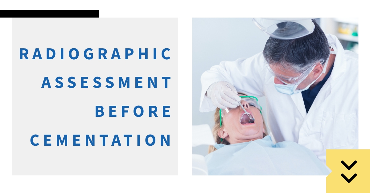 This common technique may also be unreliable. Restorative dentistry expert Dr. Bob Winter explores why. speareducation.com/spear-review/2… #dental #dentalce #dentist