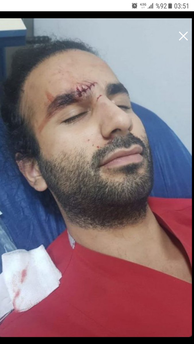 Sapioseksuel1's tweet photo. Ameliyat masasında kalınca anlarsınız ancak! Sadece birkaç saniye nefes almak istediģinizde caresiz gözlerle bakınca anlarsıñız ancak! Bir derdiniz olduğunda kıvrım kıvrım kıvrandığıñızda Dr.un gözlerinin içine baktığınız zaman anlarsınız ancak+ https://t.co/gaP9dUC2xi